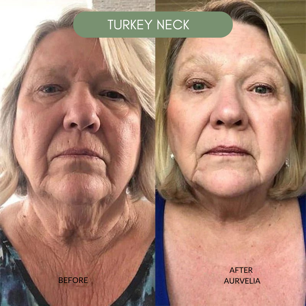 Aurvelia MultiActive Serum™
