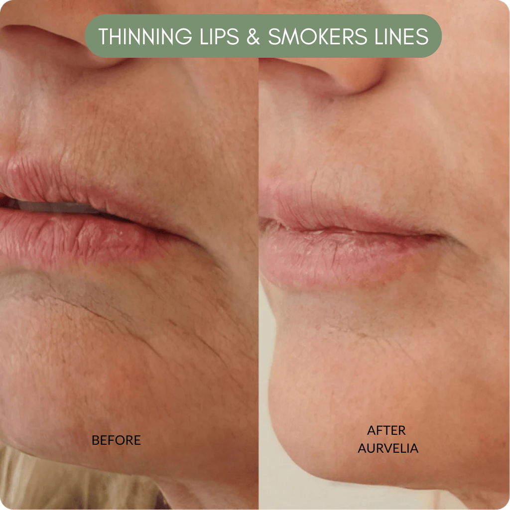 Aurvelia MultiActive Serum™