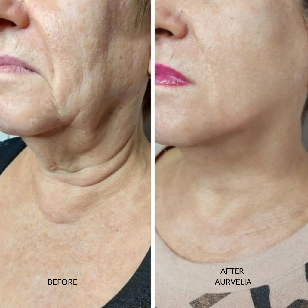 Aurvelia MultiActive Serum™ 2.0