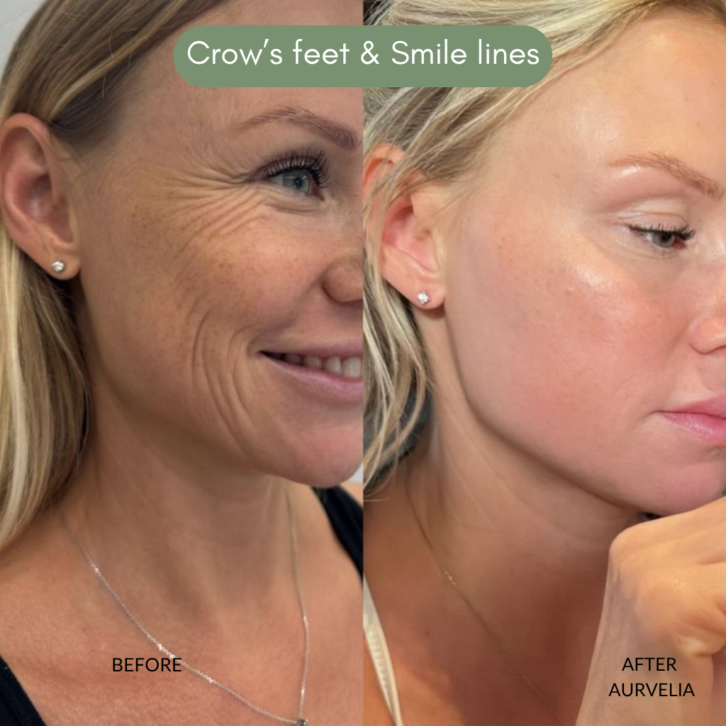 Aurvelia MultiActive Serum™ 2.0